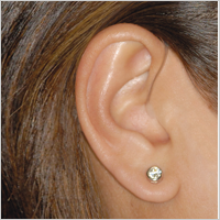 Receiver-in-canal (RIC) / Receiver-in-the-ear (RITE) hearing aid